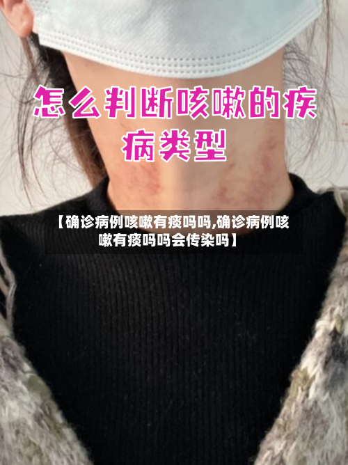 【确诊病例咳嗽有痰吗吗,确诊病例咳嗽有痰吗吗会传染吗】