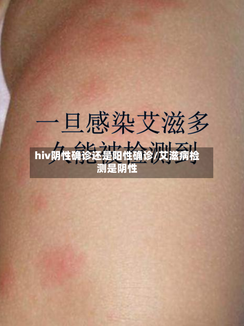 hiv阴性确诊还是阳性确诊/艾滋病检测是阴性